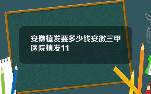 安徽植发要多少钱安徽三甲医院植发11