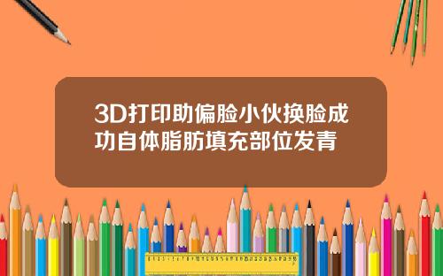 3D打印助偏脸小伙换脸成功自体脂肪填充部位发青